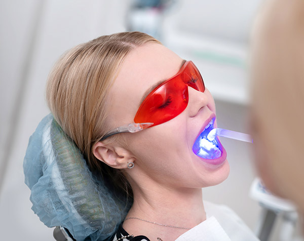 UV cleaning