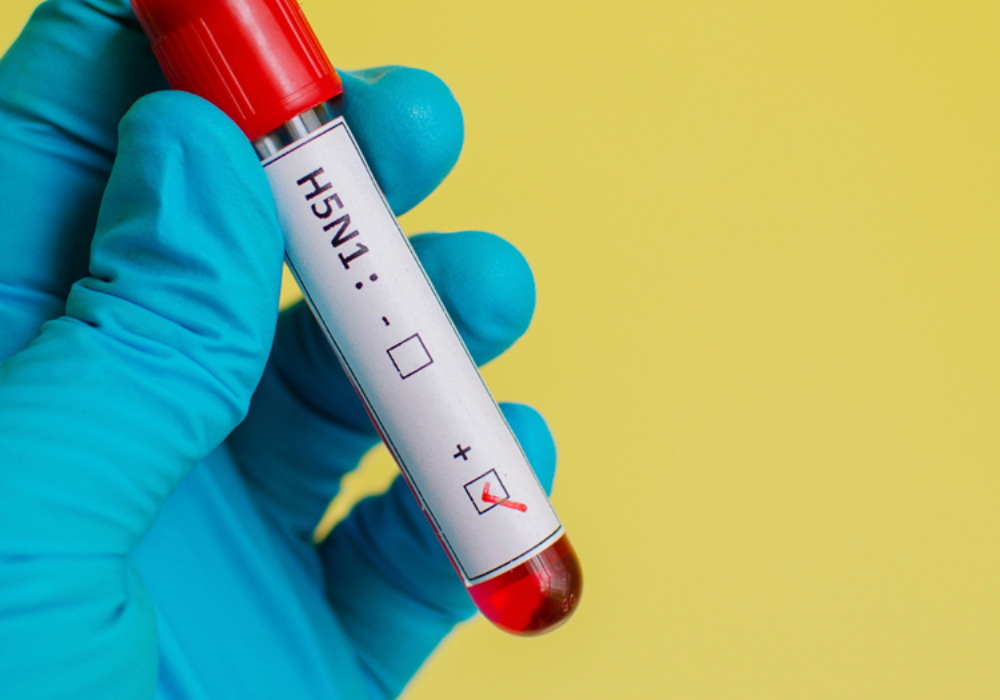 Best Practices to Guard Against Avian Influenza